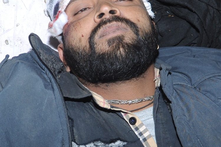 कार की टक्कर से बाइक सवार गंभीर रूप से घायल